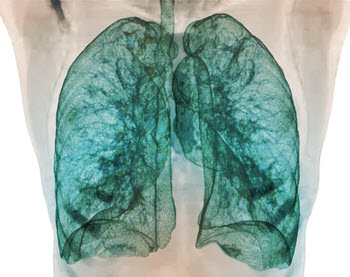 Illustration of X-rayed blue lungs